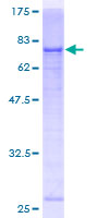 ab162499 on a 12.5% SDS-PAGE stained with Coomassie Blue.