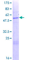 ab165122 on a 12.5% SDS-PAGE stained with Coomassie Blue.
