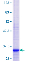 ab165123 on a 12.5% SDS-PAGE stained with Coomassie Blue.