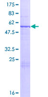 ab166181 on a 12.5% SDS-PAGE stained with Coomassie Blue.