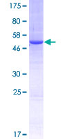 ab164203 on a 12.5% SDS-PAGE stained with Coomassie Blue.