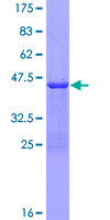 ab159283 on a 12.5% SDS-PAGE stained with Coomassie Blue.