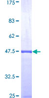 ab159284 on a 12.5% SDS-PAGE stained with Coomassie Blue.
