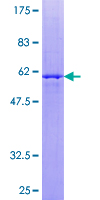 ab159747 on a 12.5% SDS-PAGE stained with Coomassie Blue.