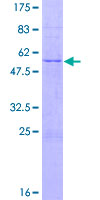 ab159702 on a 12.5% SDS-PAGE stained with Coomassie Blue.