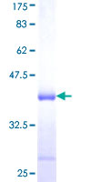 ab159703 on a 12.5% SDS-PAGE stained with Coomassie Blue.