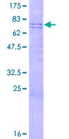 ab160336 on a 12.5% SDS-PAGE stained with Coomassie Blue.