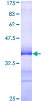 ab160337 on a 12.5% SDS-PAGE stained with Coomassie Blue.