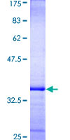 ab159669 on a 12.5% SDS-PAGE stained with Coomassie Blue.