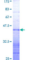 ab160203 on a 12.5% SDS-PAGE stained with Coomassie Blue.
