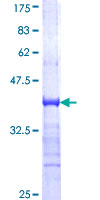 ab153358 on a 12.5% SDS-PAGE stained with Coomassie Blue.