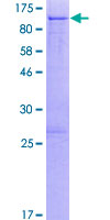 ab165891 on a 12.5% SDS-PAGE stained with Coomassie Blue.
