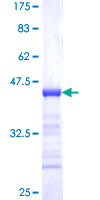 ab160263 on a 12.5% SDS-PAGE stained with Coomassie Blue.