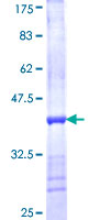 ab153573 on a 12.5% SDS-PAGE stained with Coomassie Blue.