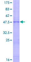 ab159704 on a 12.5% SDS-PAGE stained with Coomassie Blue.