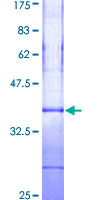 ab159705 on a 12.5% SDS-PAGE stained with Coomassie Blue.