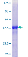ab159706 on a 12.5% SDS-PAGE stained with Coomassie Blue.