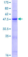 ab159707 on a 12.5% SDS-PAGE stained with Coomassie Blue.