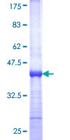 ab153274 on a 12.5% SDS-PAGE stained with Coomassie Blue.