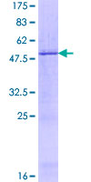 ab163788 on a 12.5% SDS-PAGE stained with Coomassie Blue.