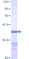 ab163246 on a 12.5% SDS-PAGE stained with Coomassie Blue.