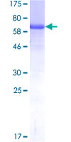 ab162916 on a 12.5% SDS-PAGE stained with Coomassie Blue.