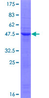 ab166096 on a 12.5% SDS-PAGE stained with Coomassie Blue.