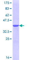 ab164945 on a 12.5% SDS-PAGE stained with Coomassie Blue.