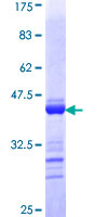 ab160480 on a 12.5% SDS-PAGE stained with Coomassie Blue.