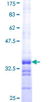ab164490 on a 12.5% SDS-PAGE stained with Coomassie Blue.