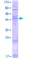 ab165106 on a 12.5% SDS-PAGE stained with Coomassie Blue.
