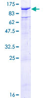 ab159711 on a 12.5% SDS-PAGE stained with Coomassie Blue.