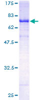 ab164124 on a 12.5% SDS-PAGE stained with Coomassie Blue.