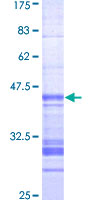 ab160694 on a 12.5% SDS-PAGE stained with Coomassie Blue.