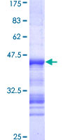 ab153152 on a 12.5% SDS-PAGE stained with Coomassie Blue.