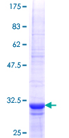 ab159713 on a 12.5% SDS-PAGE stained with Coomassie Blue.