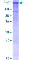 ab159714 on a 12.5% SDS-PAGE stained with Coomassie Blue.