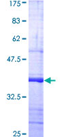 ab159715 on a 12.5% SDS-PAGE stained with Coomassie Blue.