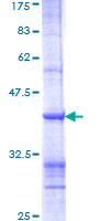 ab159716 on a 12.5% SDS-PAGE stained with Coomassie Blue.