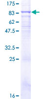 ab159717 on a 12.5% SDS-PAGE stained with Coomassie Blue.