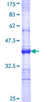 ab153069 on a 12.5% SDS-PAGE stained with Coomassie Blue.