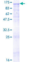 ab153344 on a 12.5% SDS-PAGE stained with Coomassie Blue.