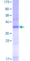 ab153365 on a 12.5% SDS-PAGE stained with Coomassie Blue.