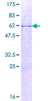 ab162313 on a 12.5% SDS-PAGE stained with Coomassie Blue.