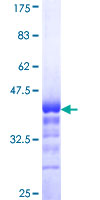 ab162314 on a 12.5% SDS-PAGE stained with Coomassie Blue.