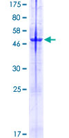 ab164454 on a 12.5% SDS-PAGE stained with Coomassie Blue.