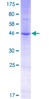 ab164224 on a 12.5% SDS-PAGE stained with Coomassie Blue.