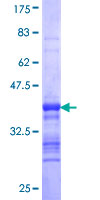 ab159719 on a 12.5% SDS-PAGE stained with Coomassie Blue.
