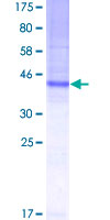ab159720 on a 12.5% SDS-PAGE stained with Coomassie Blue.