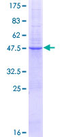 ab159721 on a 12.5% SDS-PAGE stained with Coomassie Blue.